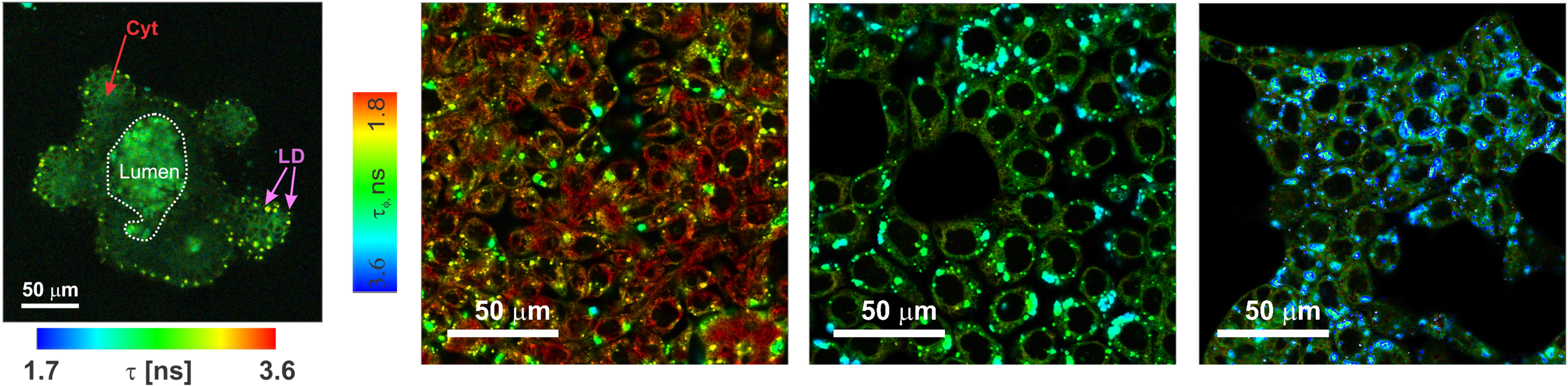 FLIM imaging of HCT116 cancer cells